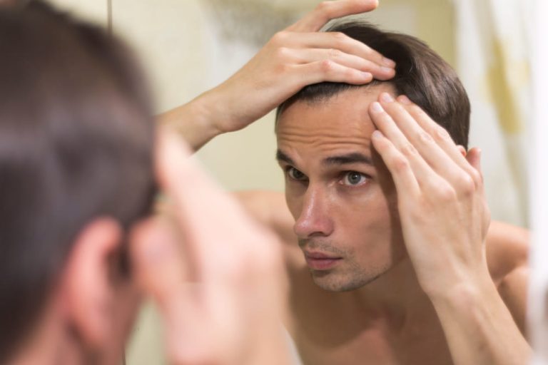 El impacto psicológico de la caída del pelo